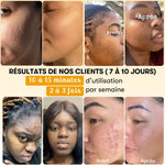 Masque anti-imperfections au Curcuma